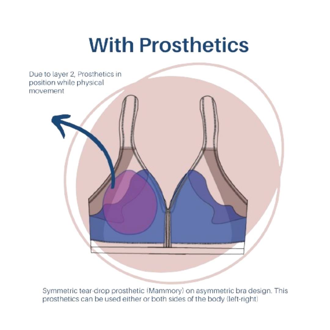 About Breast Prosthtics Deatils